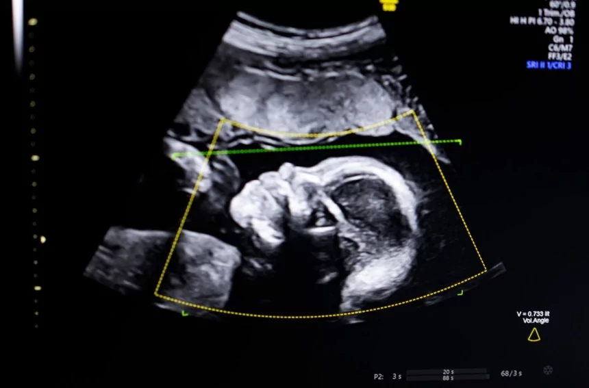 Biotics AI, Battlefield 2023, gains FDA approval for its AI-powered fetal ultrasound product 